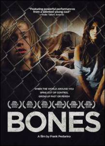  / Bones