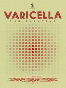  / Varicella
